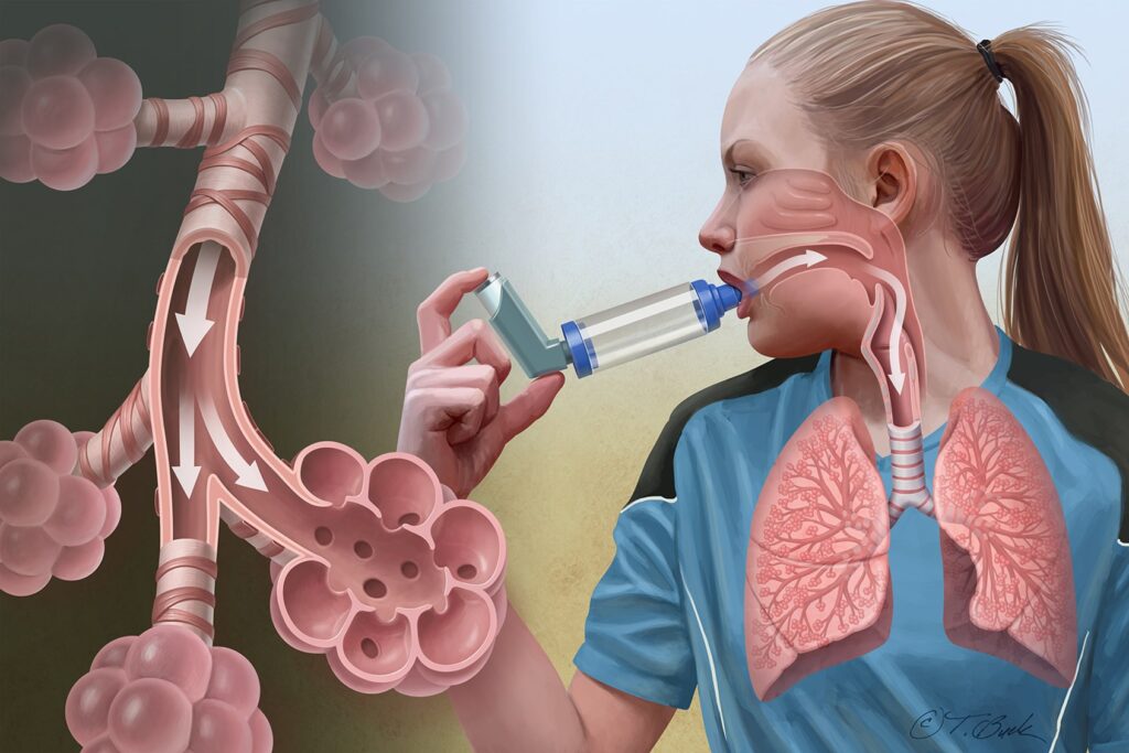 Global Airway Disease Treatment Market