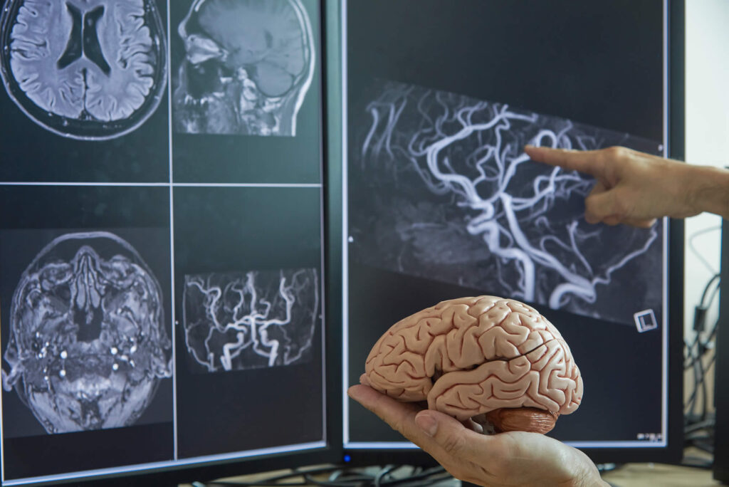 3D Printed Brain Models Market 