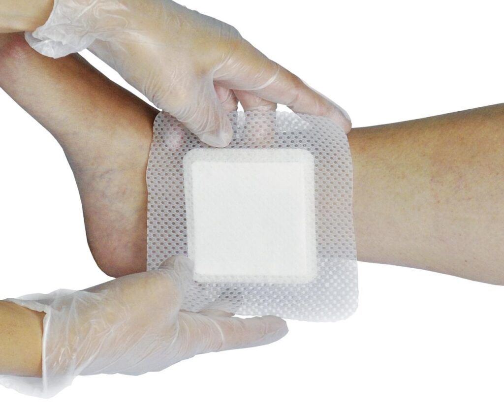 Anti-Biofilm Wound Dressing Industry