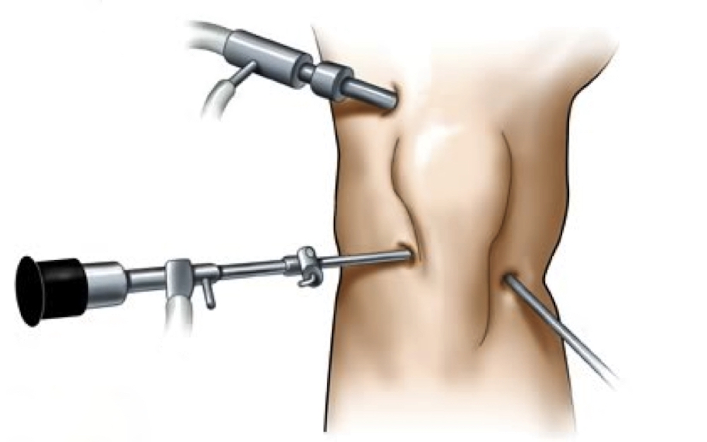 Arthroscopy Visualization Systems Market