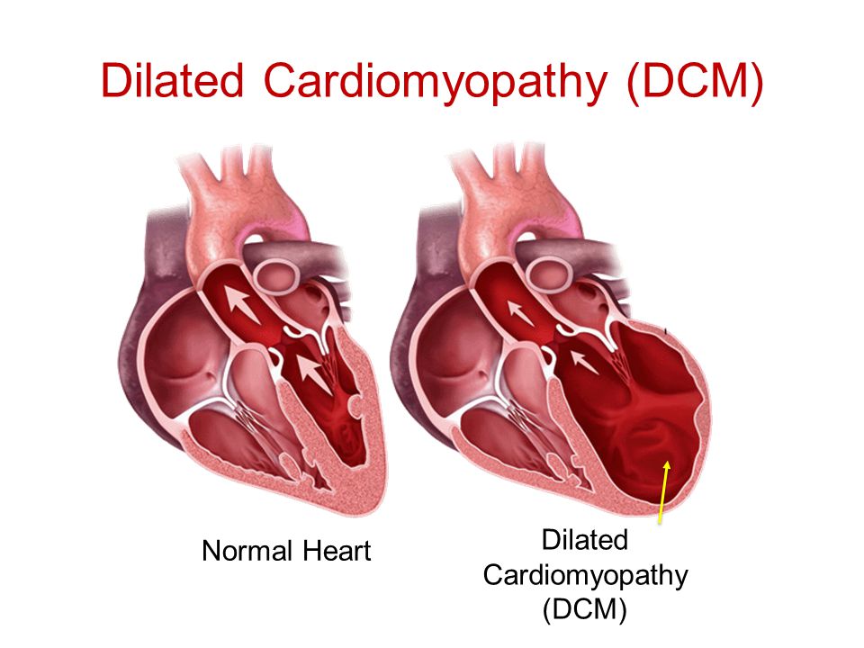 Asia Pacific’s Canine Dilated Cardiomyopathy Industry