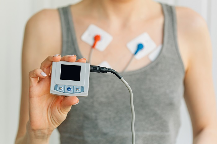 Cardiac Rhythm Remote Monitoring Devices Industry