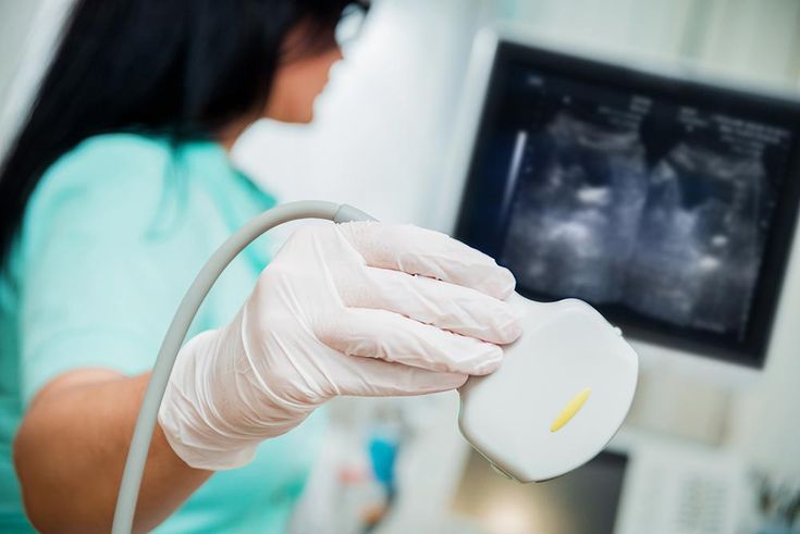 Contrast-Enhanced Ultrasound Industry