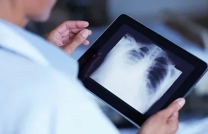 Digital Mobile X-ray Devices Market