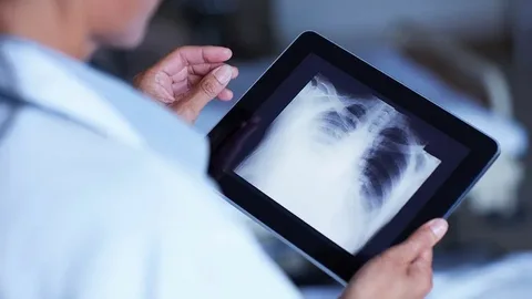 Digital Mobile X-ray Devices Market