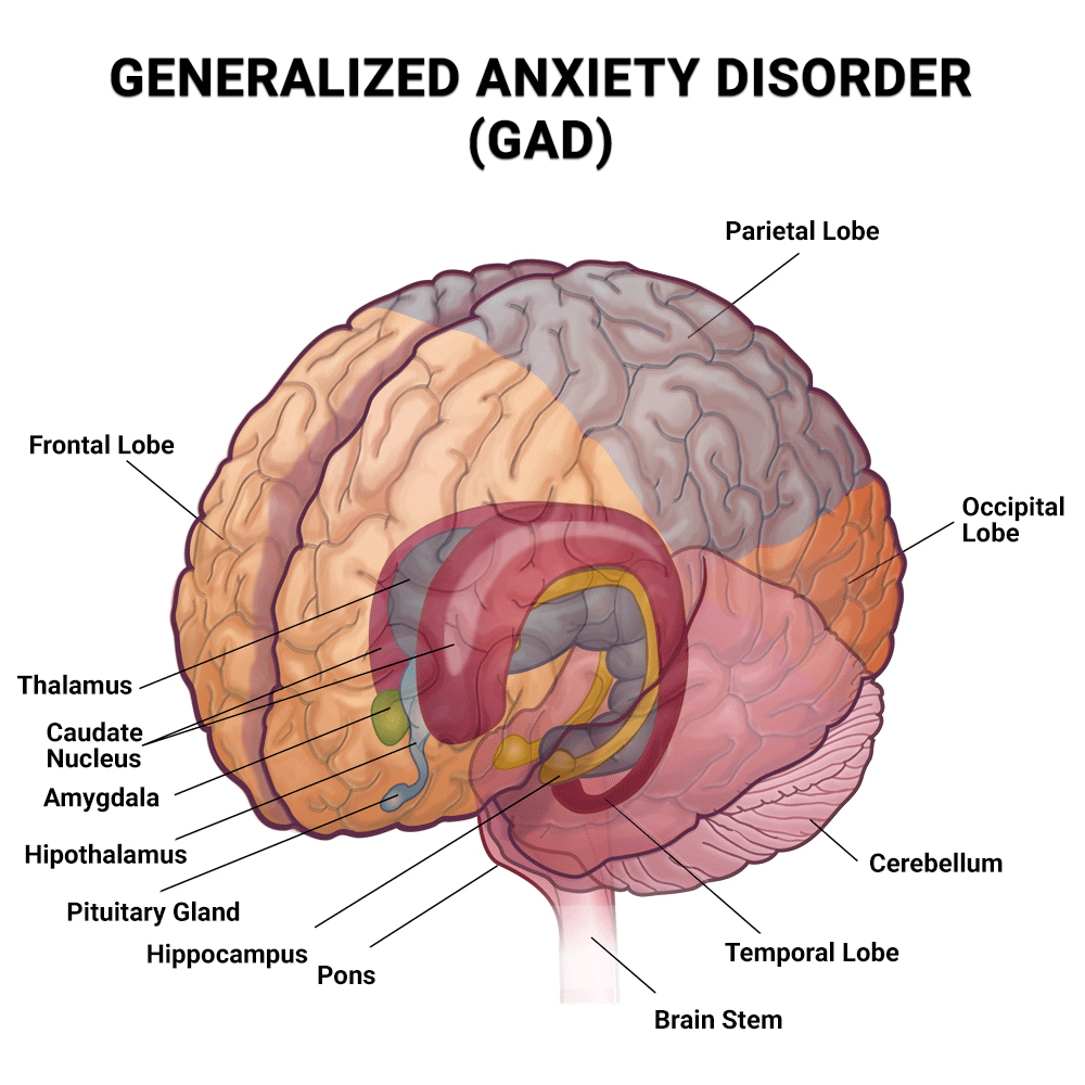 Generalized Anxiety Disorder Treatment Industry