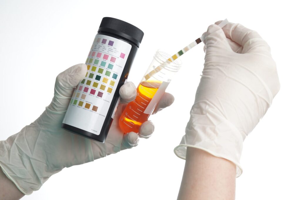 Genomic Urine Testing Market