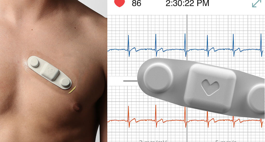 Global Multi-Channel Remote ECG Monitors Industry