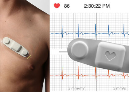 Global Multi-Channel Remote ECG Monitors Industry