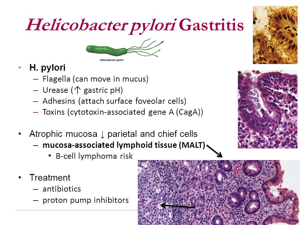 Helicobacter Pylori Infections Treatment Industry