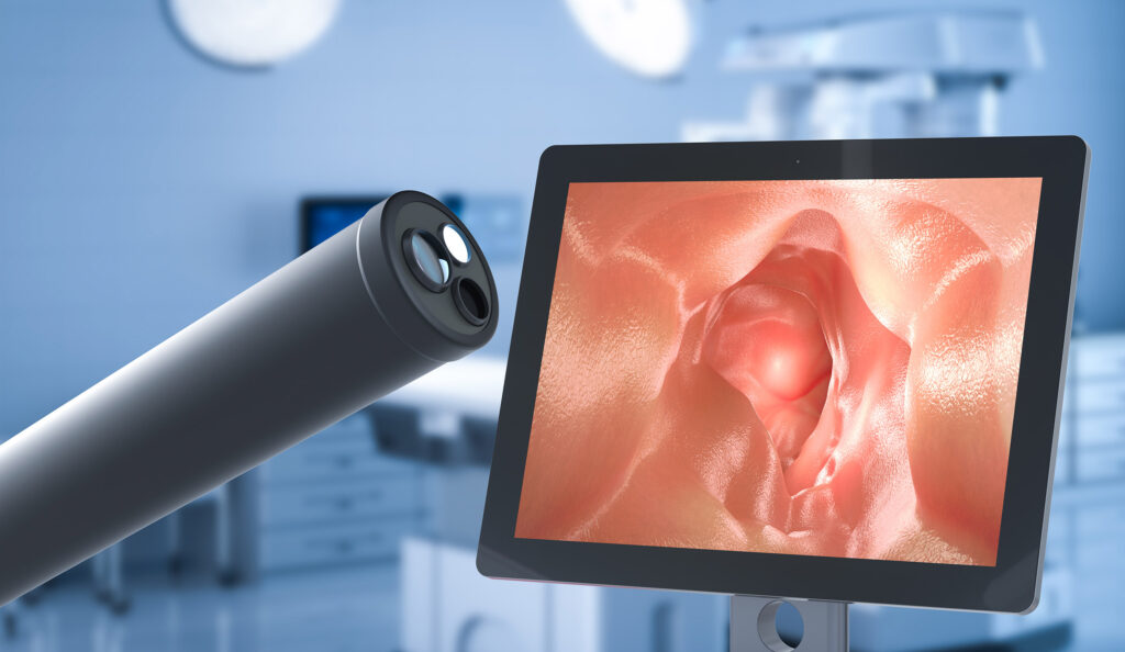 Mobile Endoscopic Workstations Industry