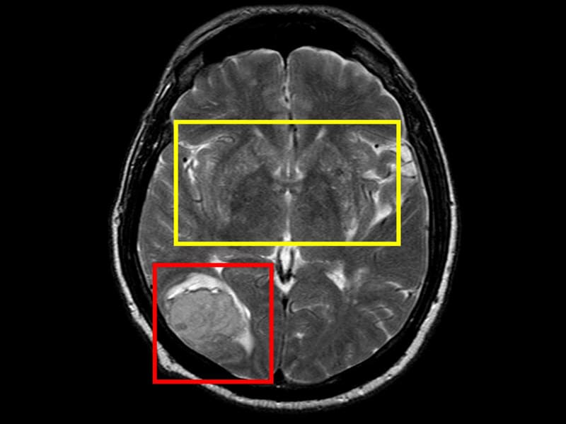 Perfusion Imaging Market