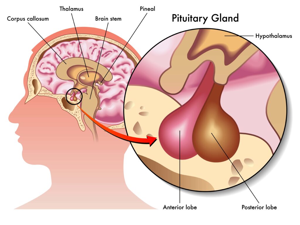 Pituitary Stalk Interruption Syndrome Treatment Industry