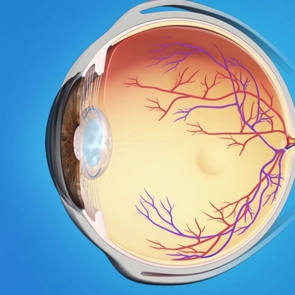 Retinal Vein Occlusion Treatment Market