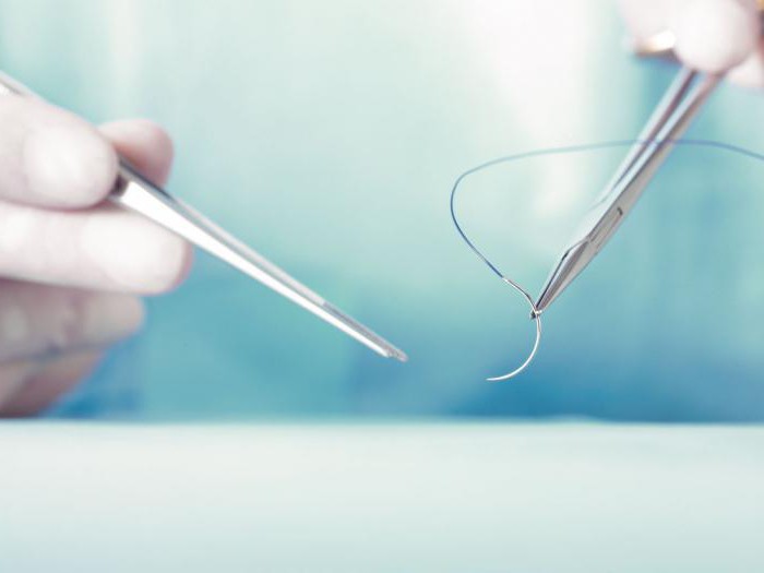 Surgical Sutures Market