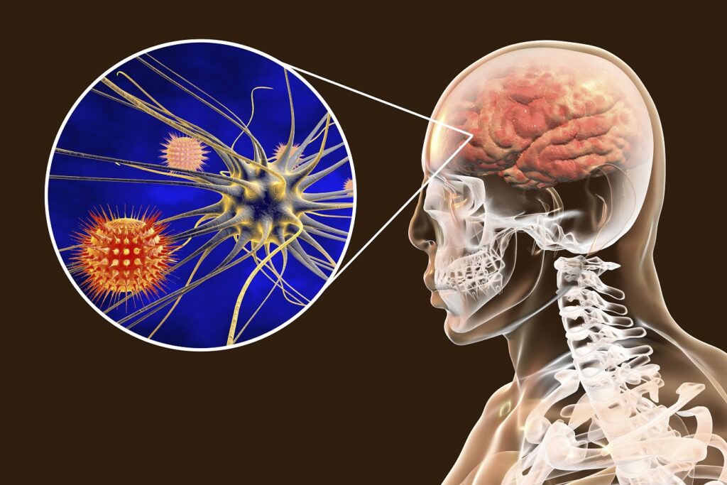 Tuberculous Meningitis Treatment Industry