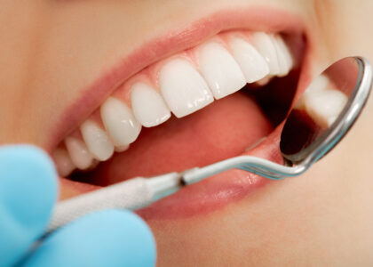 Global Dental Adhesives Industry