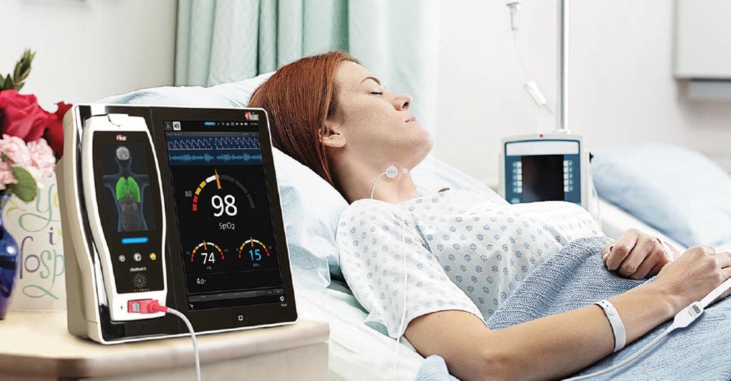 Acoustic Respiration Sensors Industry