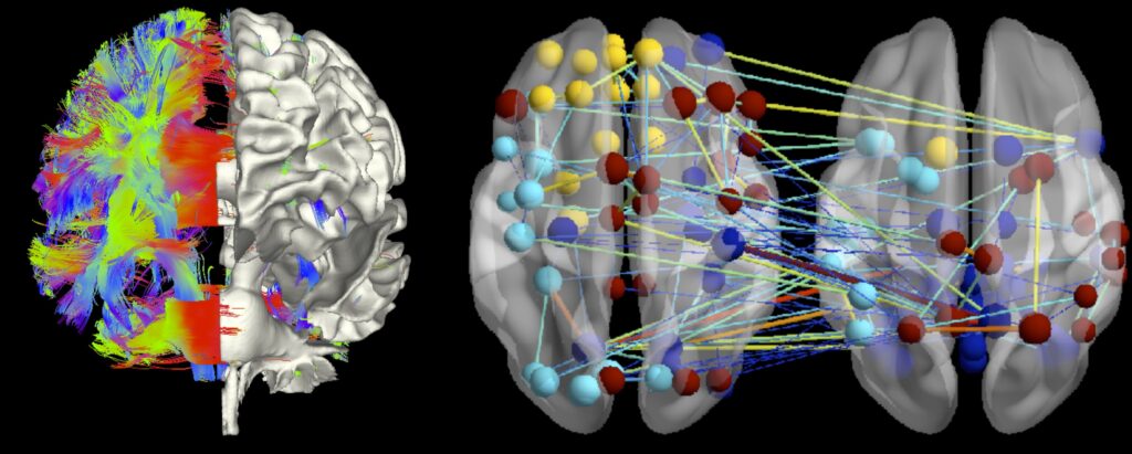 Brain Imaging and Neuroimaging Industry