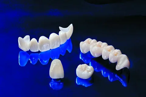 Dental Ceramics Market