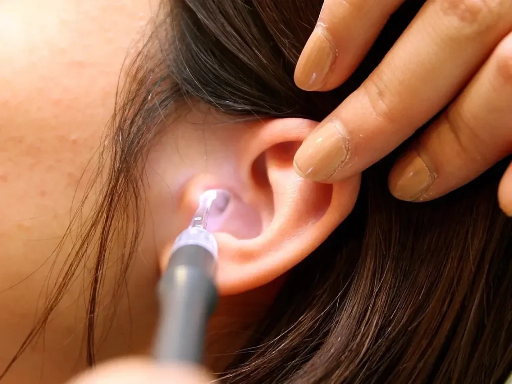 Earwax Removal Market