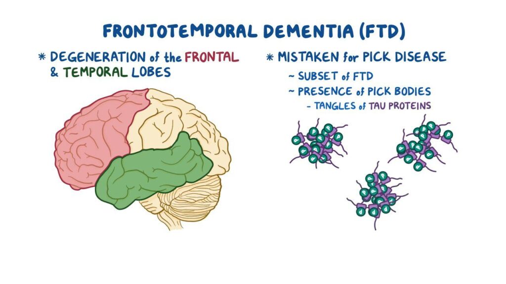 Frontotemporal Dementia Management Industry