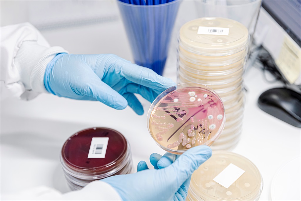 Fungal Testing Kits Industry