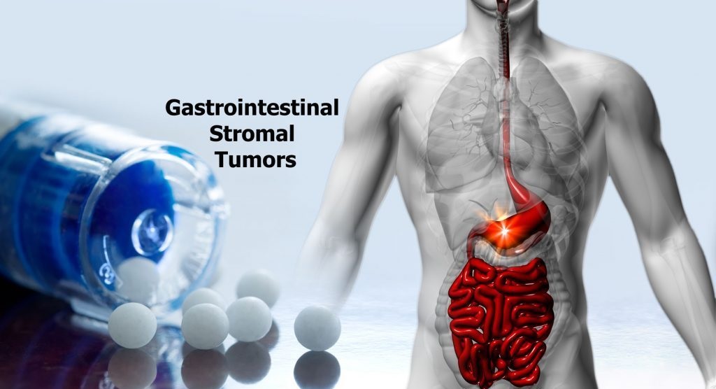 Gastrointestinal Stromal Tumor (GIST) Therapeutics Market