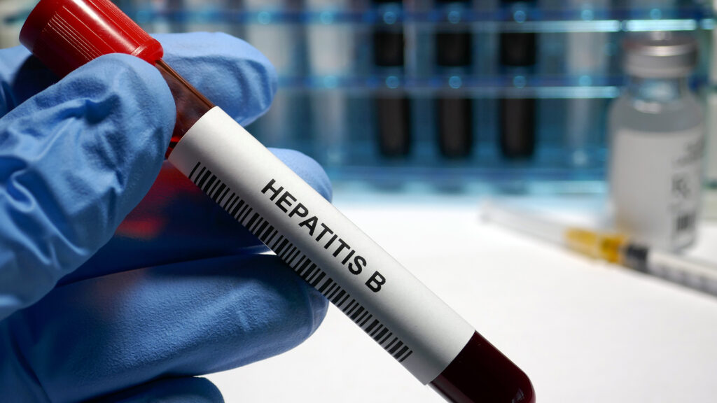 Hepatitis B Diagnostic Tests Industry