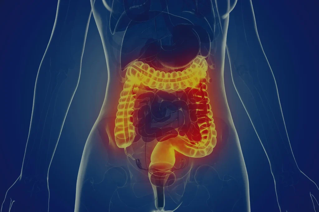 Inflammatory Bowel Disease Treatment Market