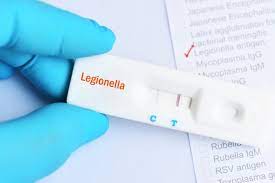 Legionnaire Disease Testing market