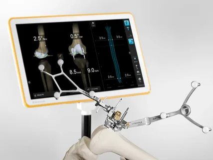 Orthopedic Navigation Systems Market