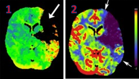 Perfusion Imaging Industry