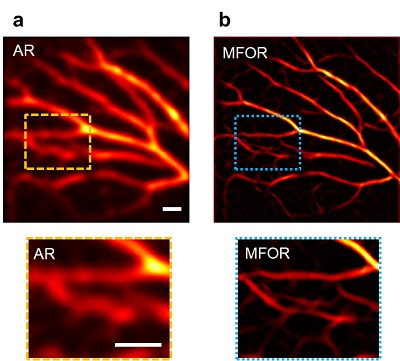 Photoacoustic Microscopy Industry