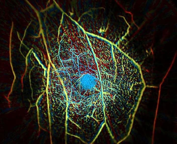 Photoacoustic Tomography Market