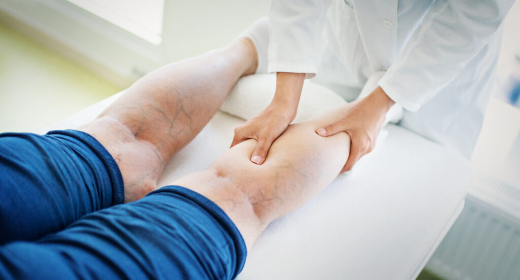 Venous Ulcer Treatment Market 