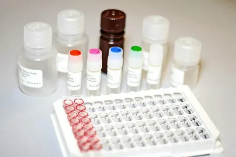 Viral RNA Extraction Kit Market