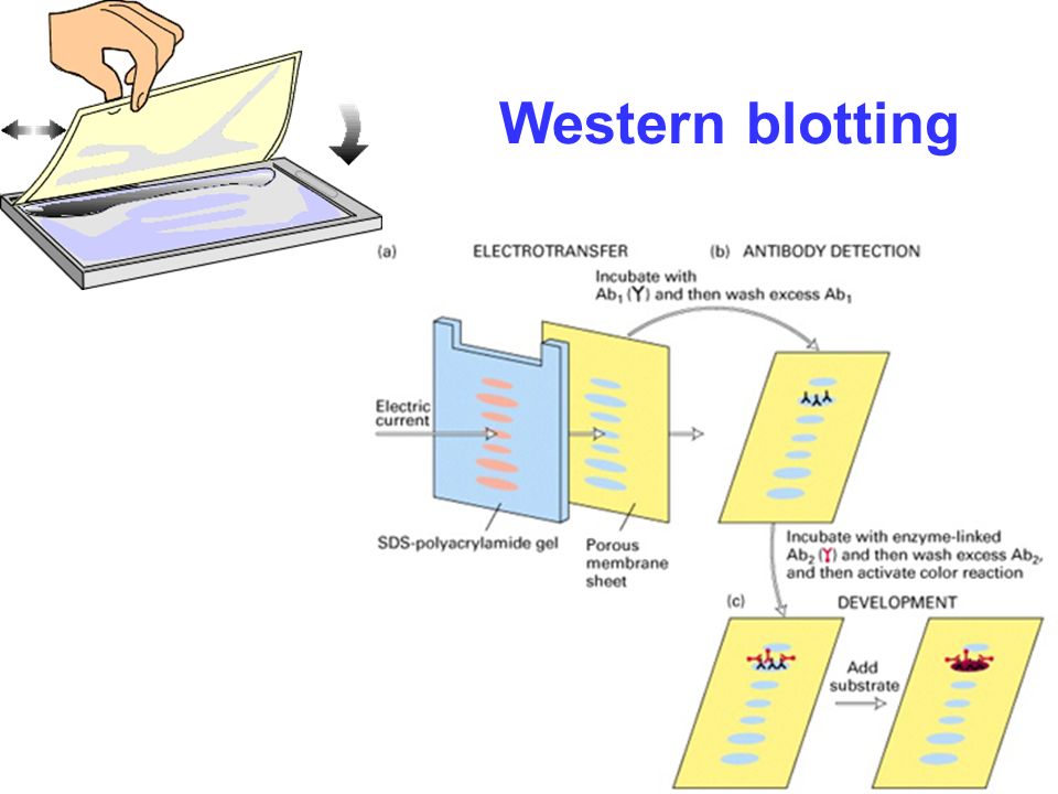 Western Blotting Market