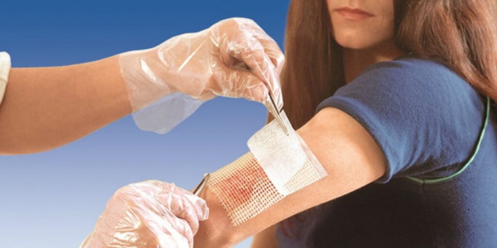 Wound Evacuators Industry