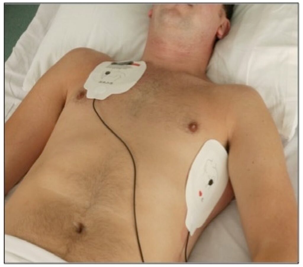 Automated CPR Devices Market