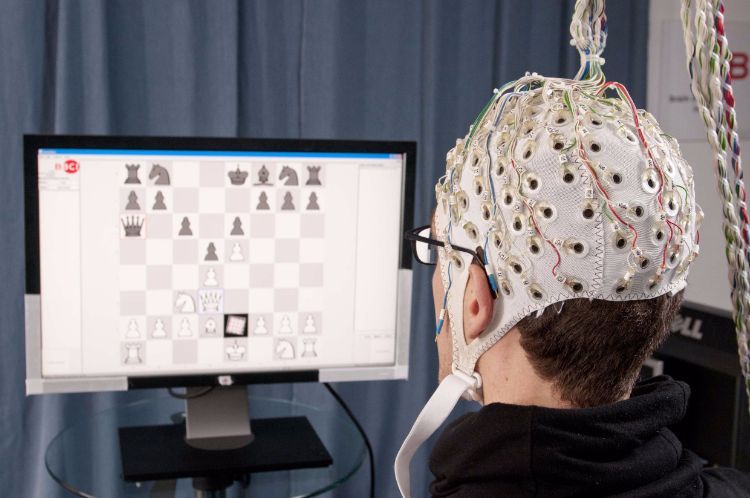 Brain Monitoring Systems Industry