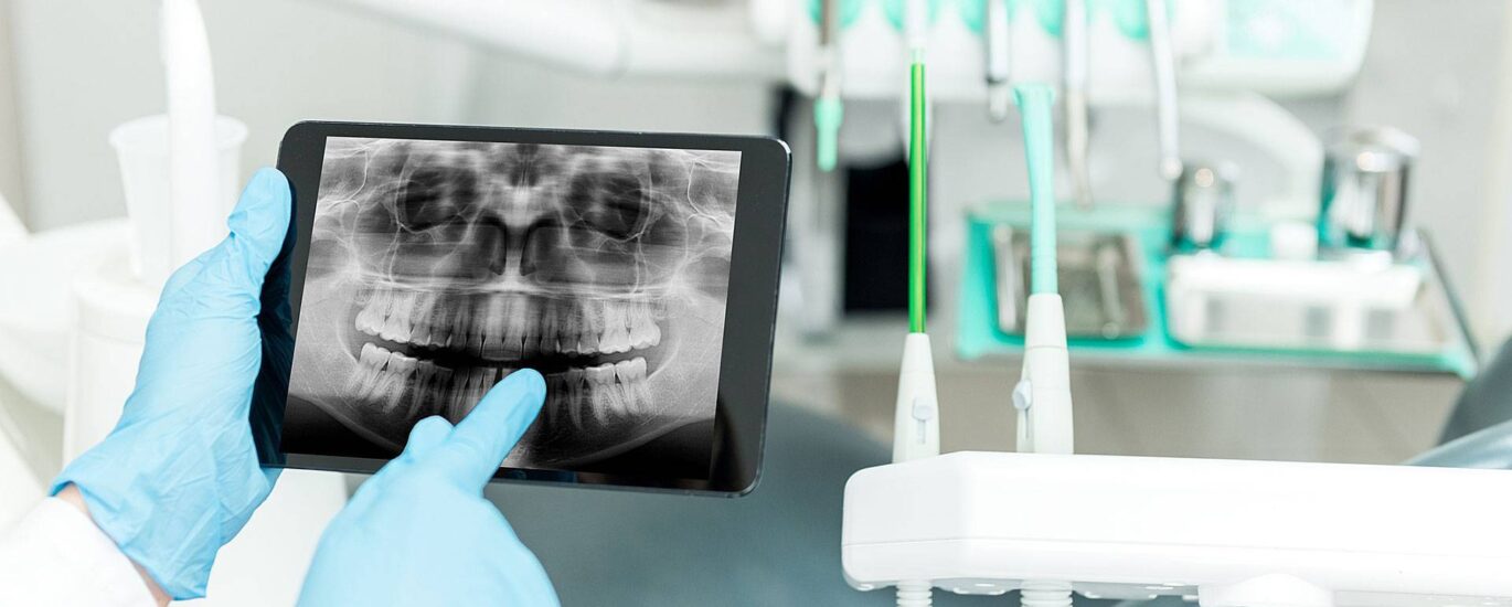 Global Dental X-ray Systems Industry