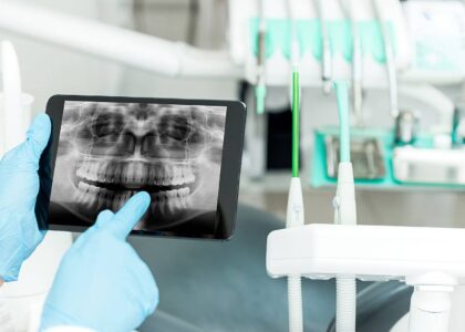 Global Dental X-ray Systems Industry