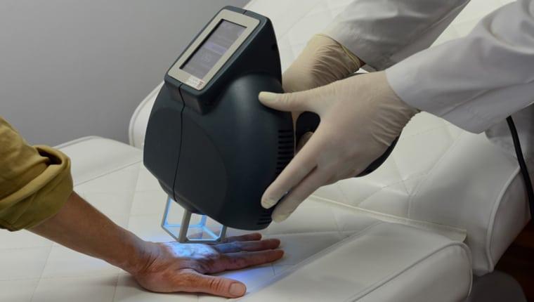 Dermatology Excimer Lasers Industry