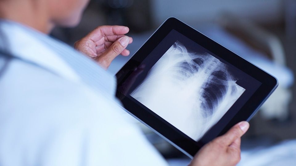 Digital Mobile X-ray Devices Market