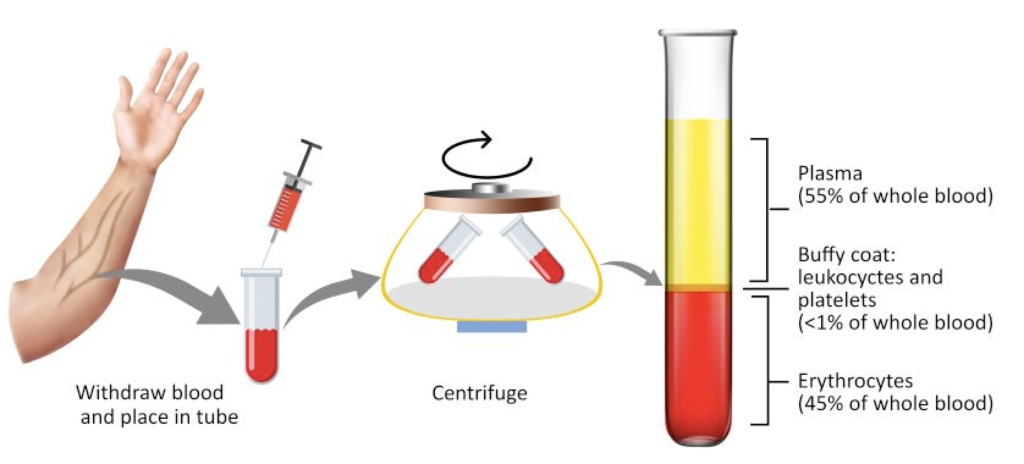 Europe Platelet Rich Plasma (PRP) Industry