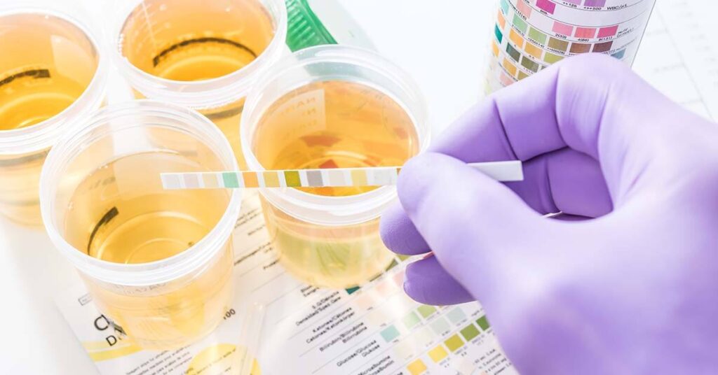 Genomic Urine Testing Industry