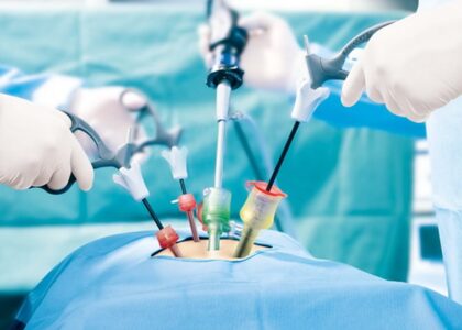 Global Bariatric Surgery Devices Industry