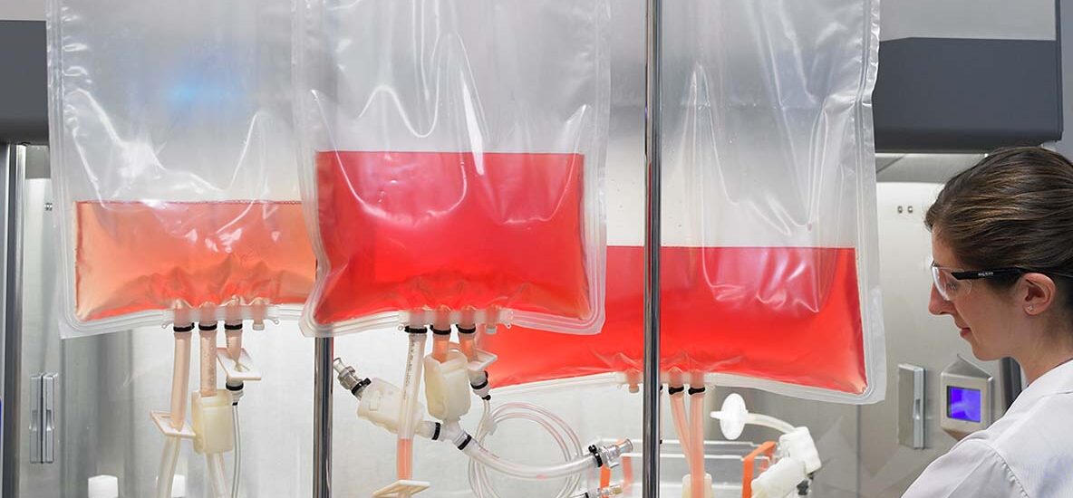 Global Cell Culture Media Bags Industry