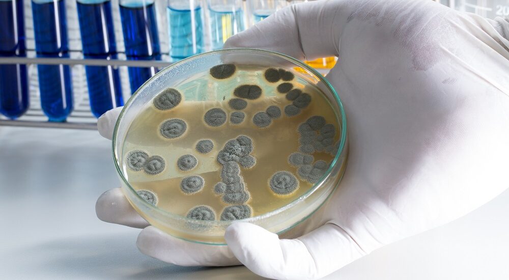 Global Microbial Therapeutic Products Industry